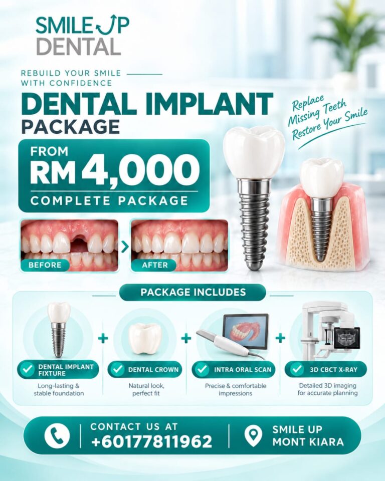 Dental implant complete package from RM4,000